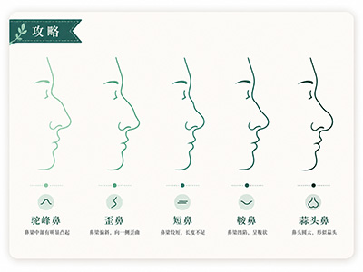 Giải ph&aacute;p chỉnh sửa dị dạng mũi